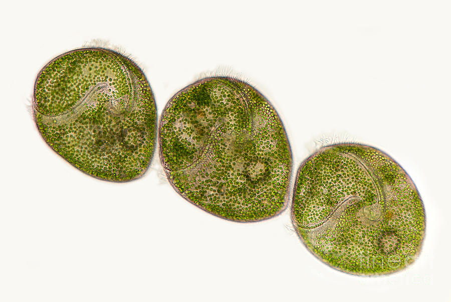 Stentor Sp. Protozoans, Lm Photograph by Marek Mis
