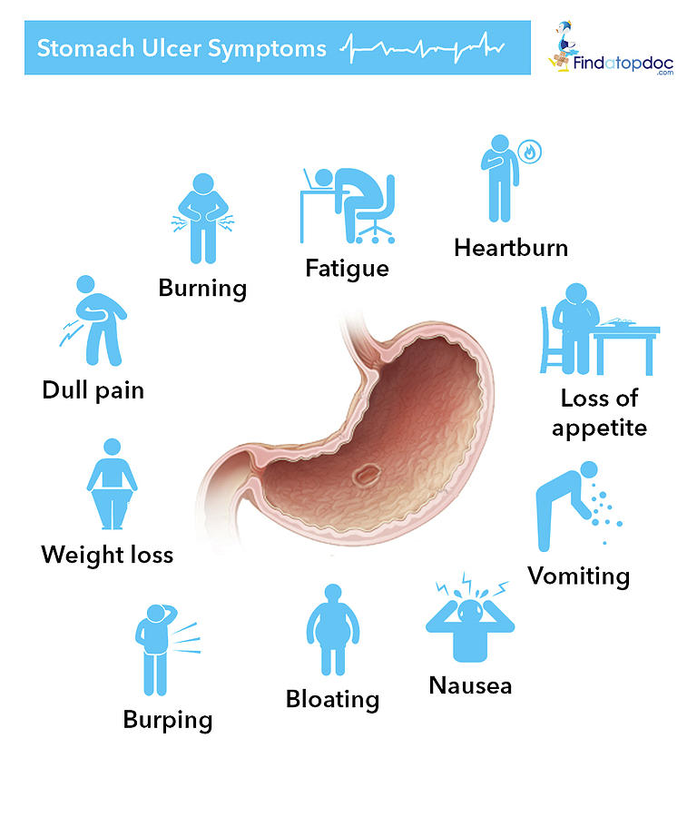 Stomach Ulcer Symptoms Photograph By Findatopdoc Fine Art America 1957