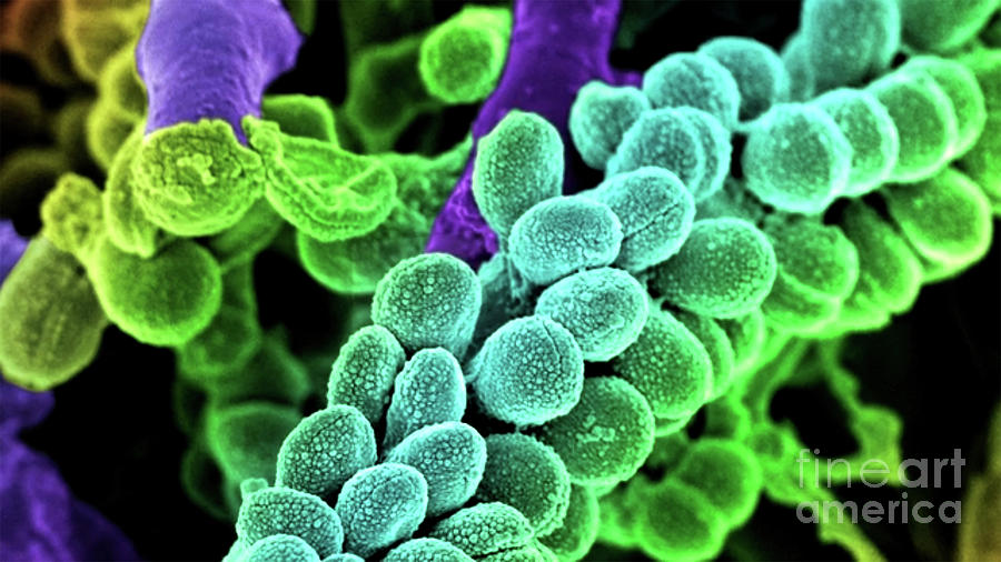 Streptococcus Bacteria - Colored scanning electron micrograph. Photograph by Doc Braham