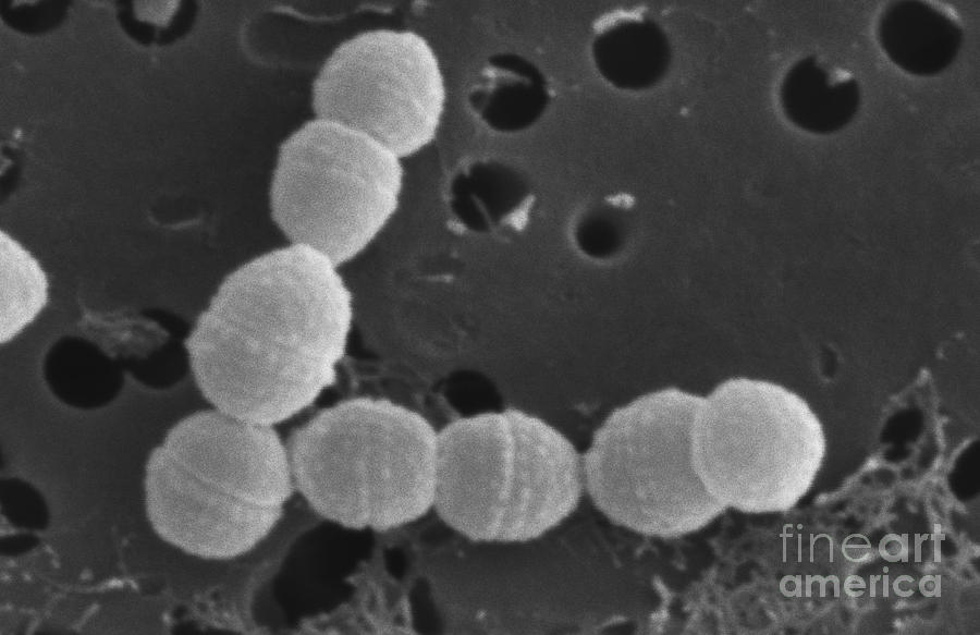 Streptococcus Cremoris Photograph by Scimat