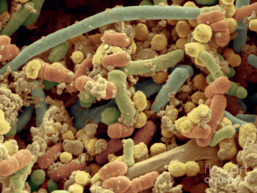 Streptococcus Pyogenes Photograph by Scimat