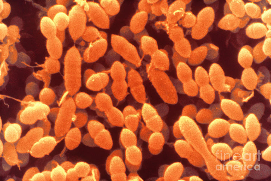 Streptococcus Sanguinis, Sem Photograph by Scimat