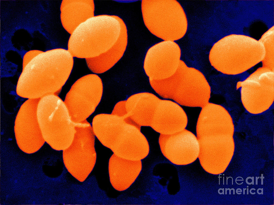 Streptococcus Sanguis Photograph by Scimat