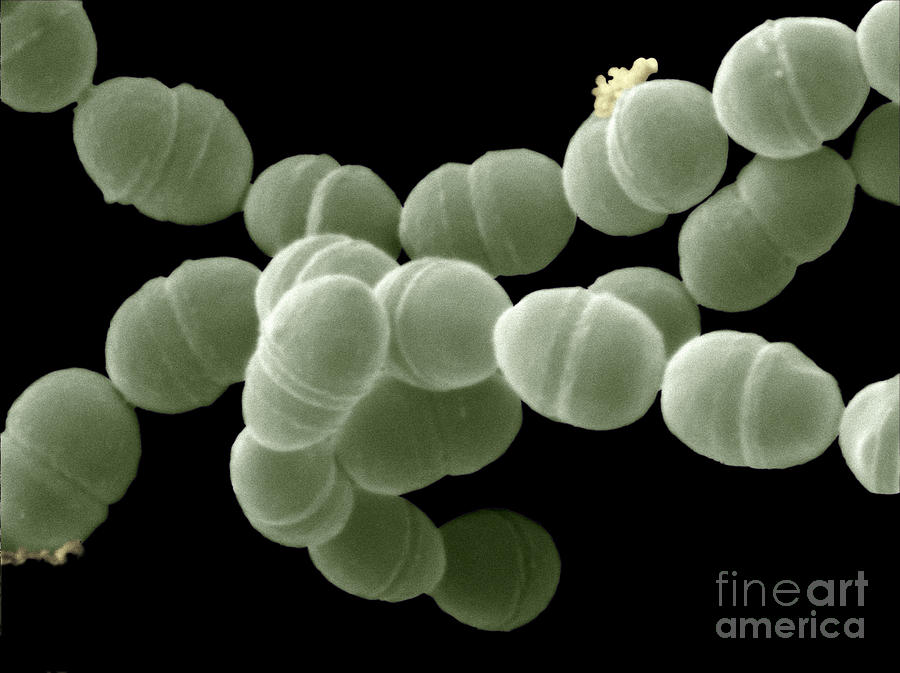 Streptococcus Thermophilus Bacteria Sem Photograph by Scimat