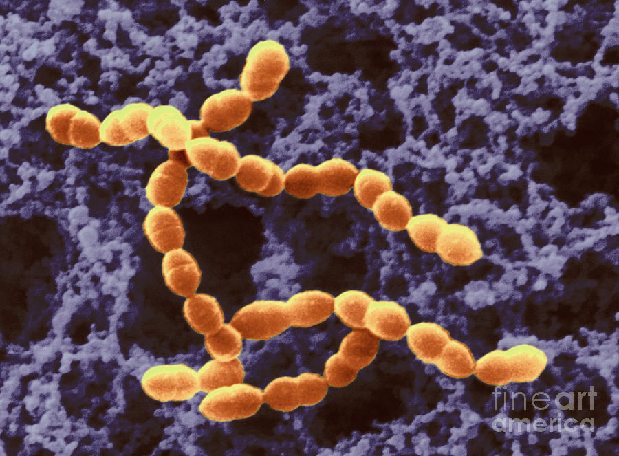 Streptococcus Thermophilus In Yogurt Photograph by Scimat