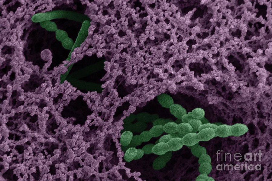 Streptococcus Thermophilus Photograph by Scimat