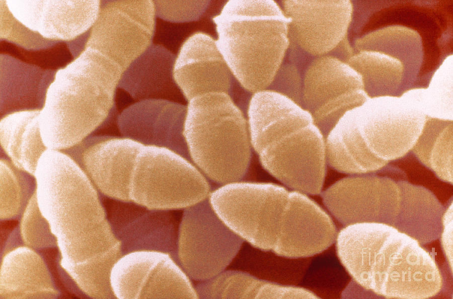Streptococcus Thermophilus, Sem Photograph by Scimat