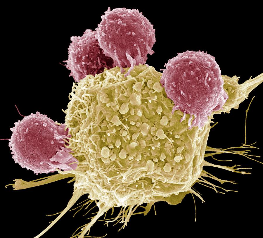 T Lymphocytes And Cancer Cell, Sem Photograph by Steve Gschmeissner