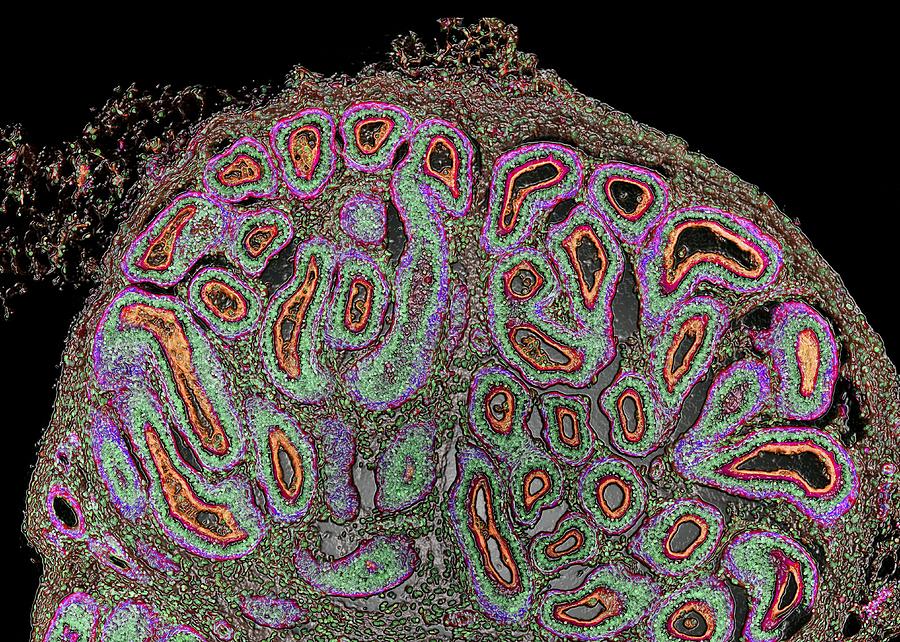 Sertoli Cell Photograph - Testis, Confocal Light Micrograph by Thomas Deerinck, Ncmir