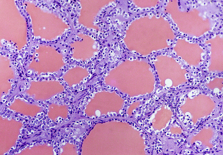 Thyroid Gland Light Micrograph Photograph By Steve Gschmeissner