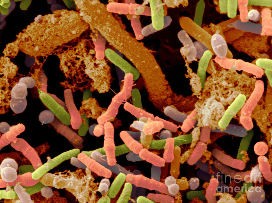 Toddlers Feces With Bifidobacteria, Sem Photograph by Scimat