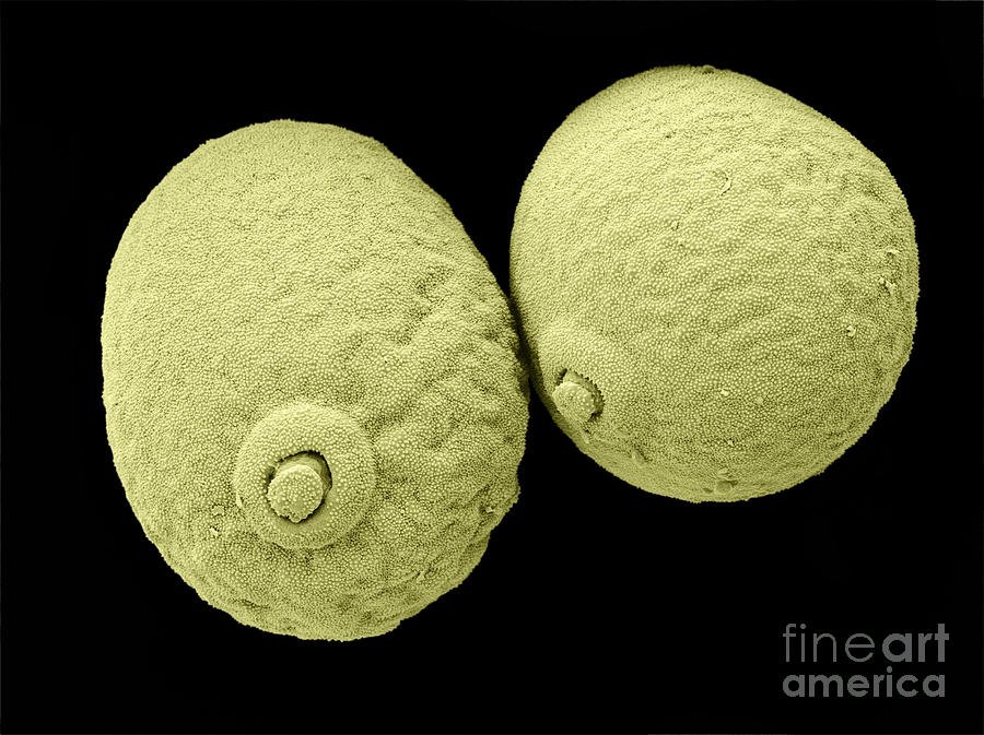 Triticale Pollen Photograph by Scimat