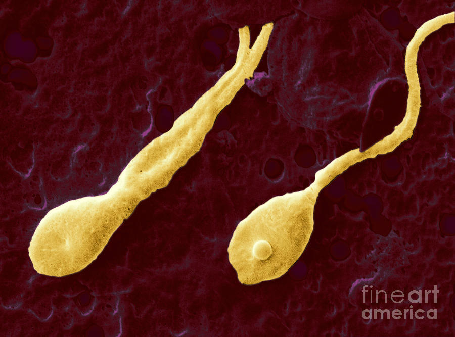 Two-tailed Sperm Cell Photograph by Scimat