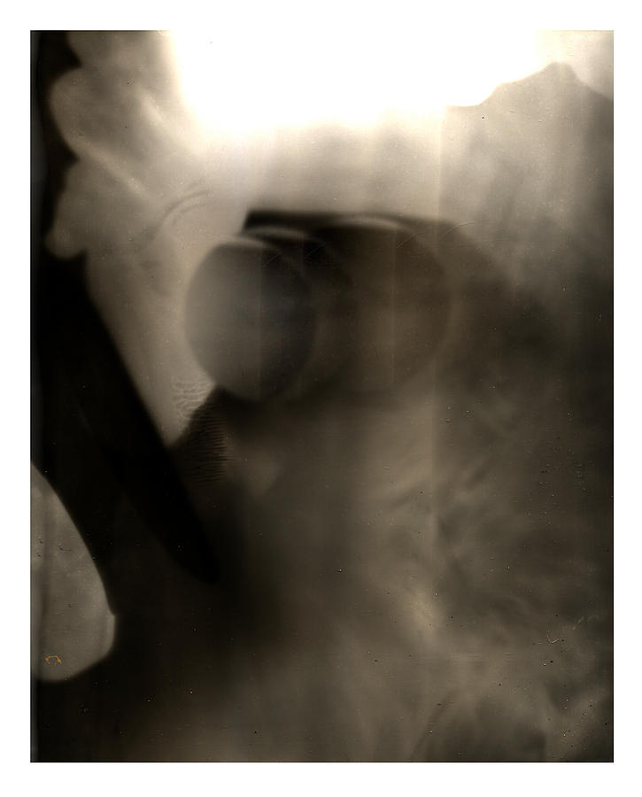 X-ray Digital Art - Untitled 27b by Doug Duffey