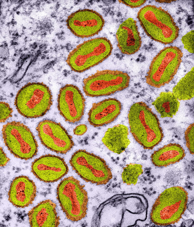 Cowpox Photograph - Vaccinia Viruses, Tem by Dr Klaus Boller