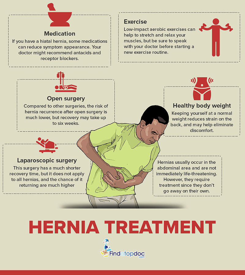 Signs And Symptoms Of A Hernia And Home Treatments Of Hernias Epic