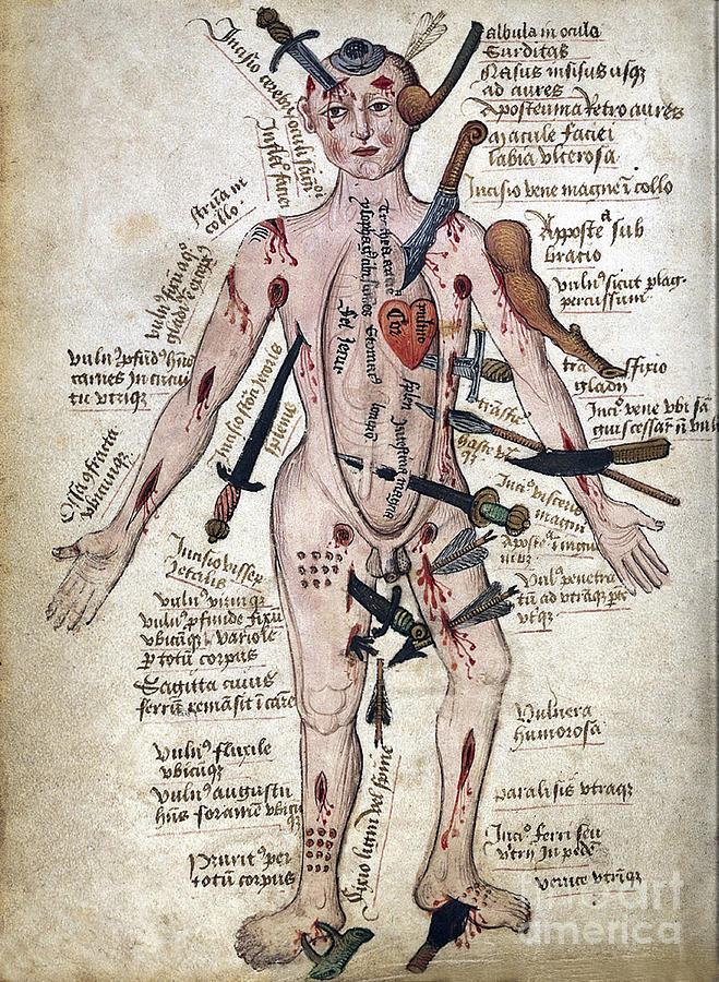 Wound Man, 15th Century Photograph by Wellcome Images