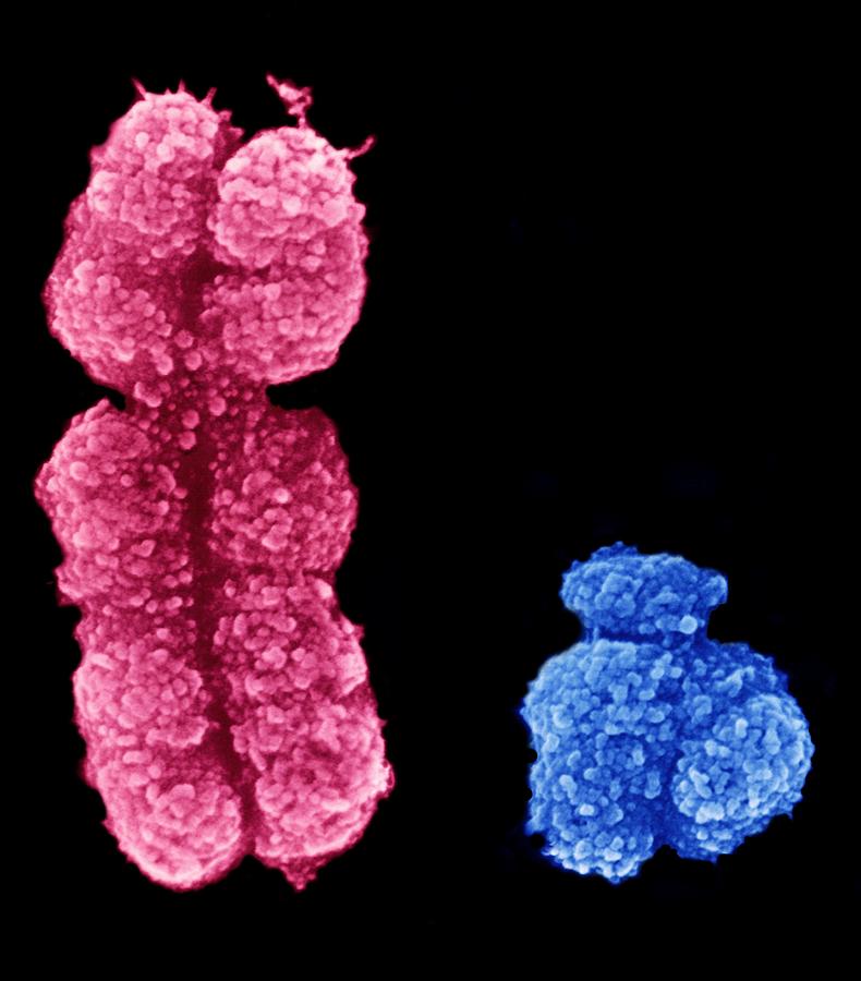 Human Chromosome Photograph - X And Y Chromosomes by 