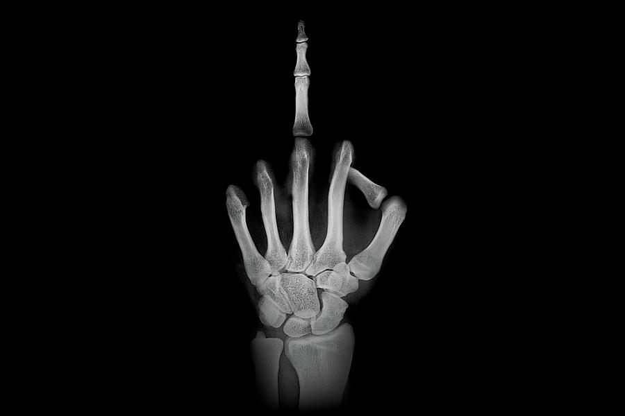Abstract Photograph - X-ray - Giving The Finger by Mountain Dreams