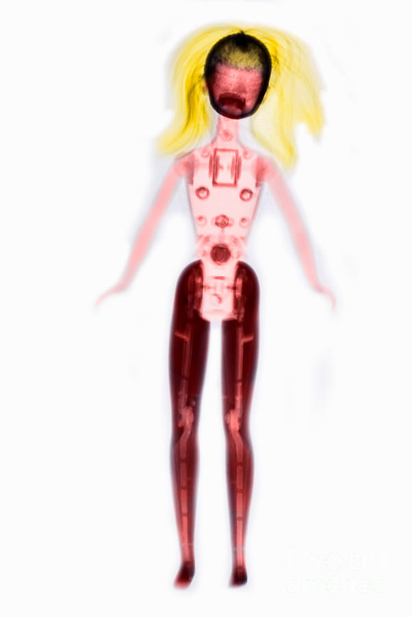 X-ray Of Barbie Doll Photograph by Scott Camazine
