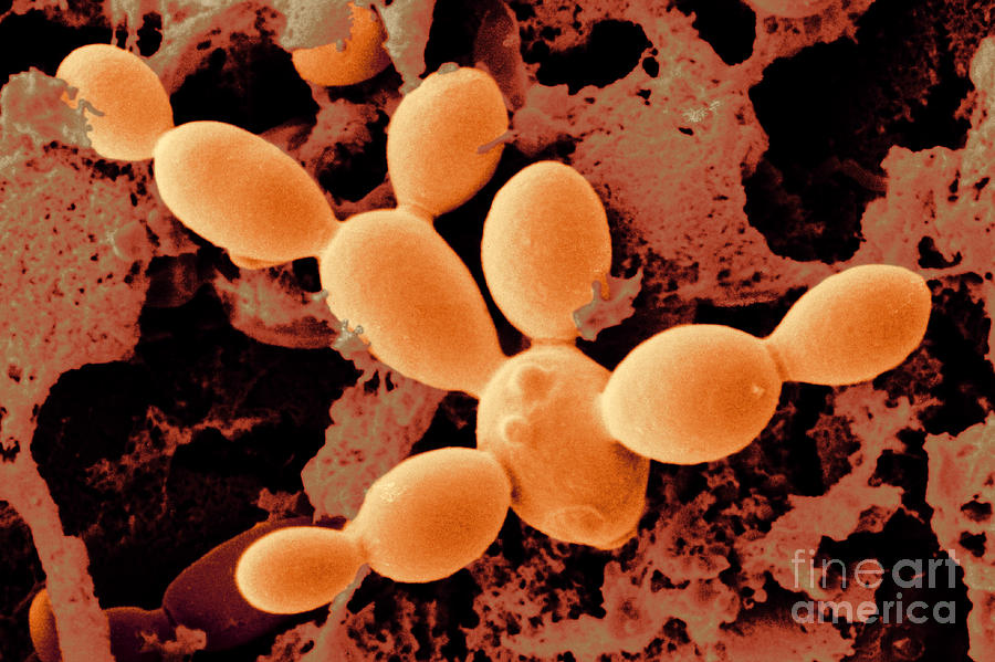 Yeast Cells Photograph by Scimat
