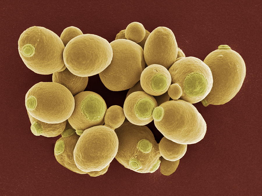 Nature Photograph - Yeast Cells, Sem by Steve Gschmeissner