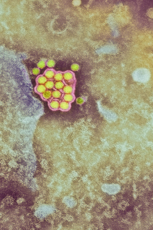 Yellow Fever Photograph - Yellow Fever Virus Particles, Tem by London School Of Hygiene & Tropical Medicine