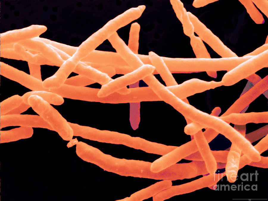 Yersinia Enterocolitica Bacteria Photograph by Scimat