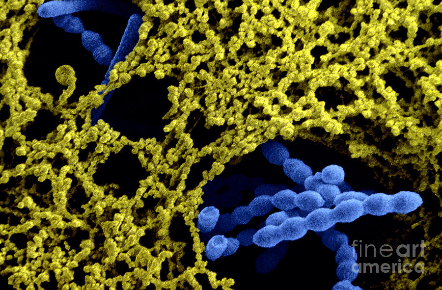 Yogurt Bacteria, Colored Sem Photograph by Scimat