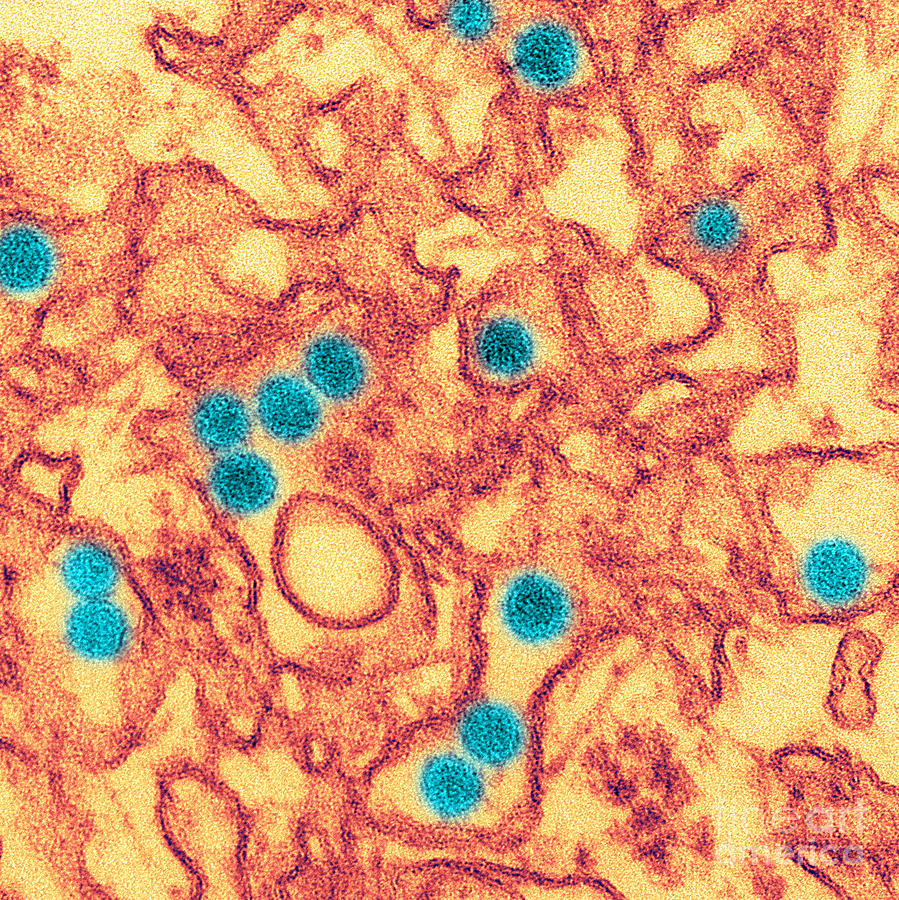 Zika Virus, Tem Photograph by Science Source