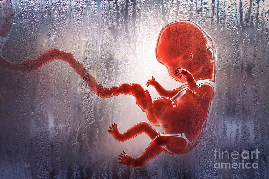 Abortion #1 Photograph by Kateryna Kon/science Photo Library