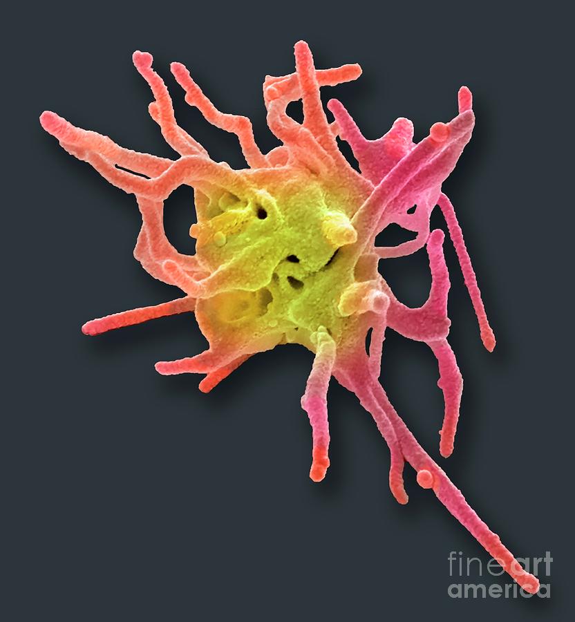 Activated Platelet Photograph by Steve Gschmeissner/science Photo ...