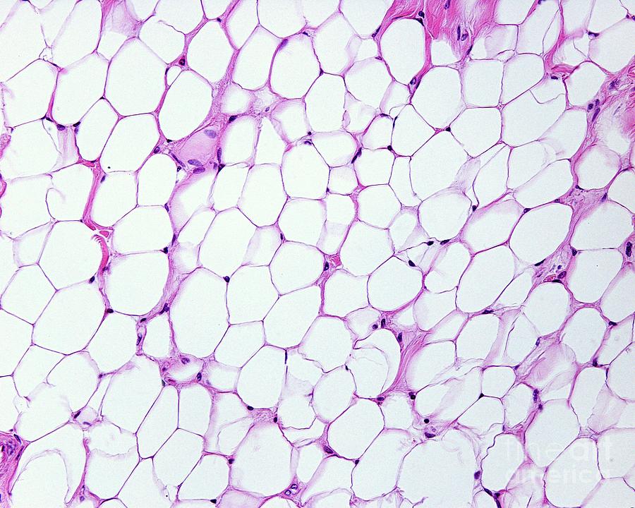 Adipose Tissue #1 Photograph by Jose Calvo/science Photo Library