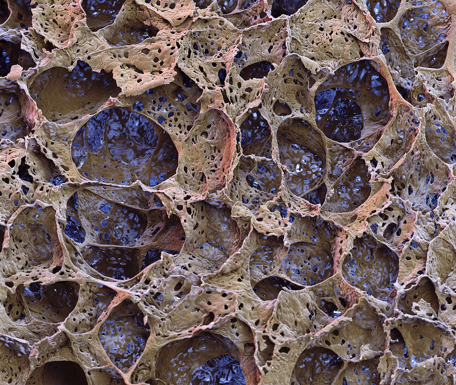 Alveoli With Capillaries, Sem #1 Photograph by Meckes/ottawa