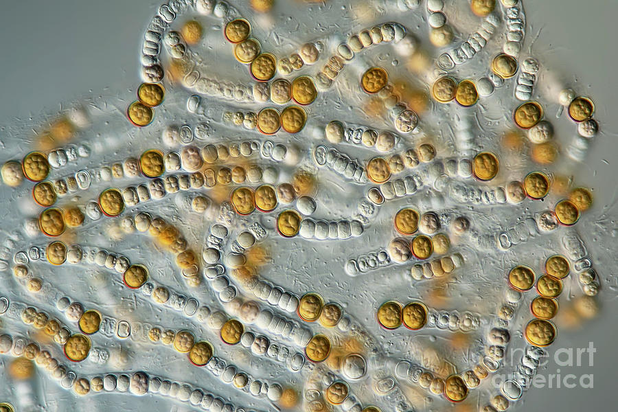Anabaena Sp. Algae #1 Photograph by Frank Fox/science Photo Library