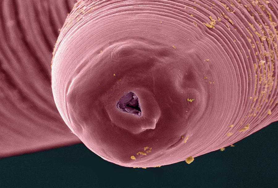 Ground Worm Under Microscope