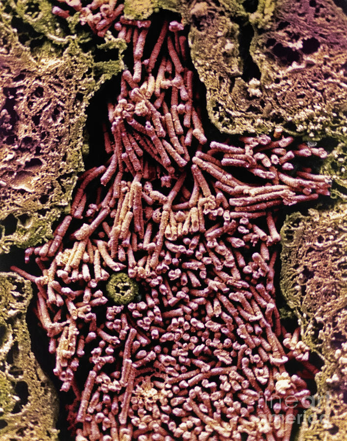 Anthrax Bacteria #1 Photograph by A. Dowsett, National Infection Service/science Photo  Library