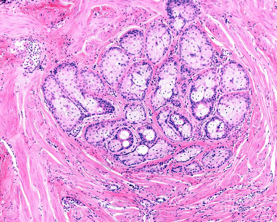 Areola Gland #1 Photograph by Jose Calvo/science Photo Library