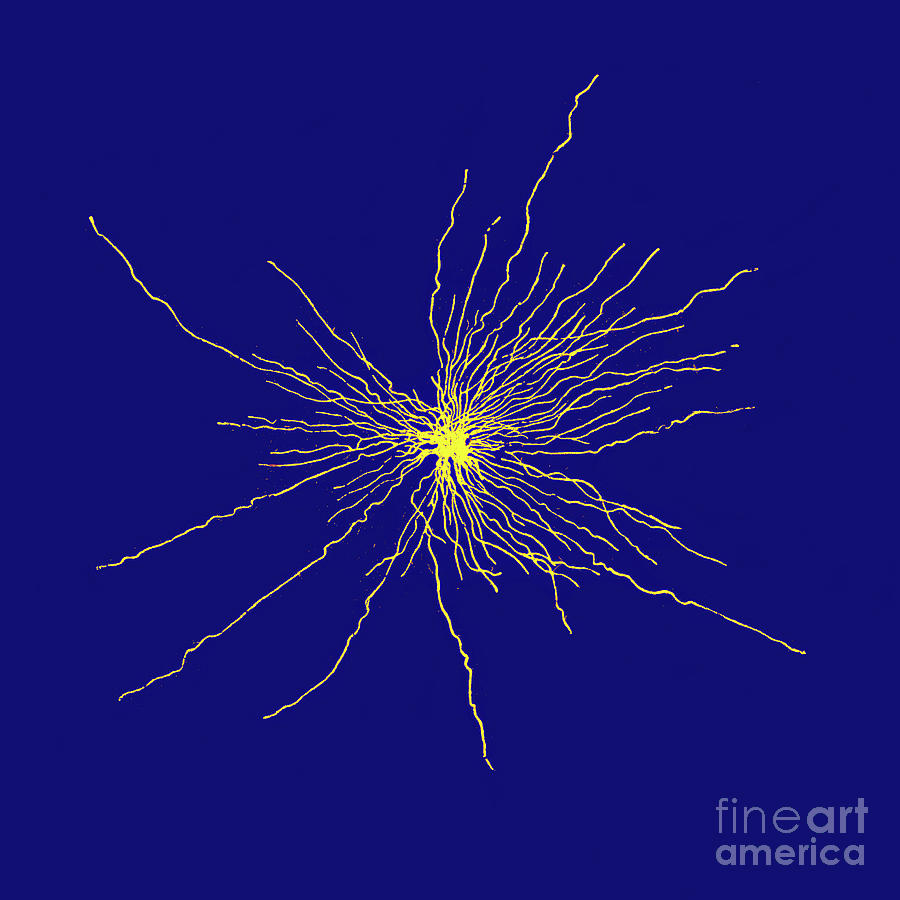 Astrocyte Spinal Cord Cell #1 Photograph by Collection Abecasis/science Photo Library