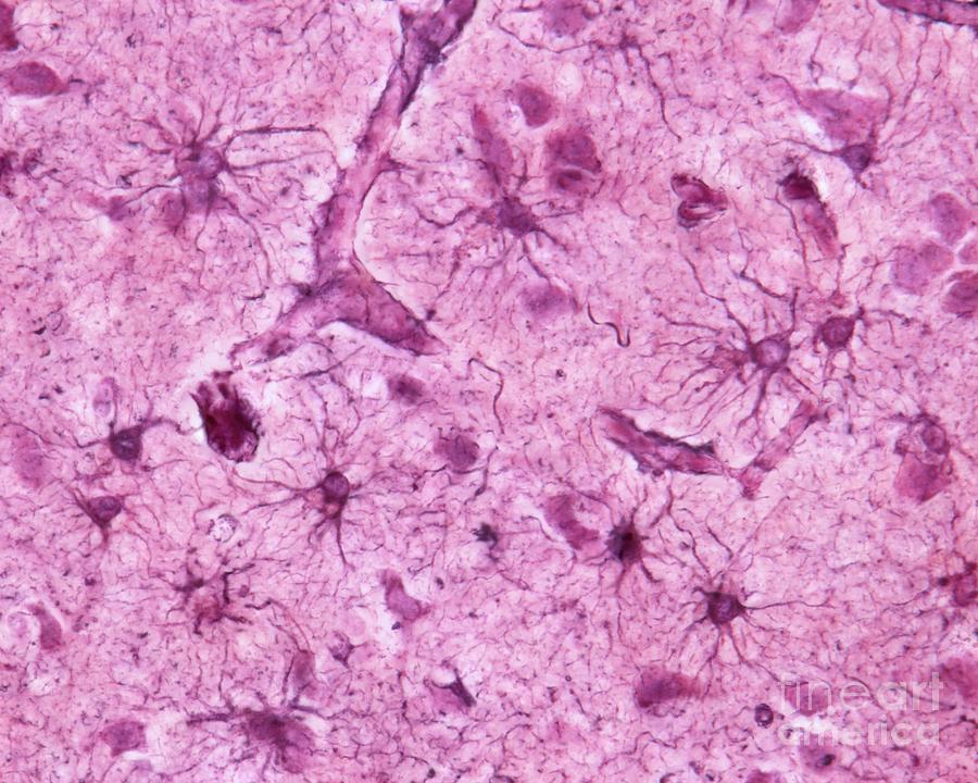 Astrocytes #1 Photograph by Jose Calvo / Science Photo Library