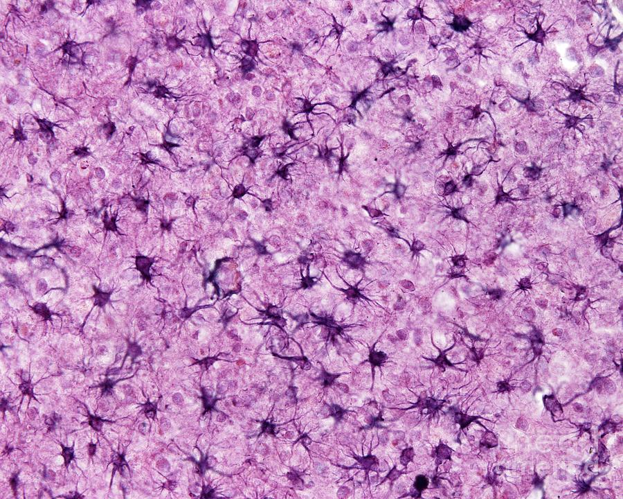 Astrocytes #1 Photograph by Jose Calvo / Science Photo Library