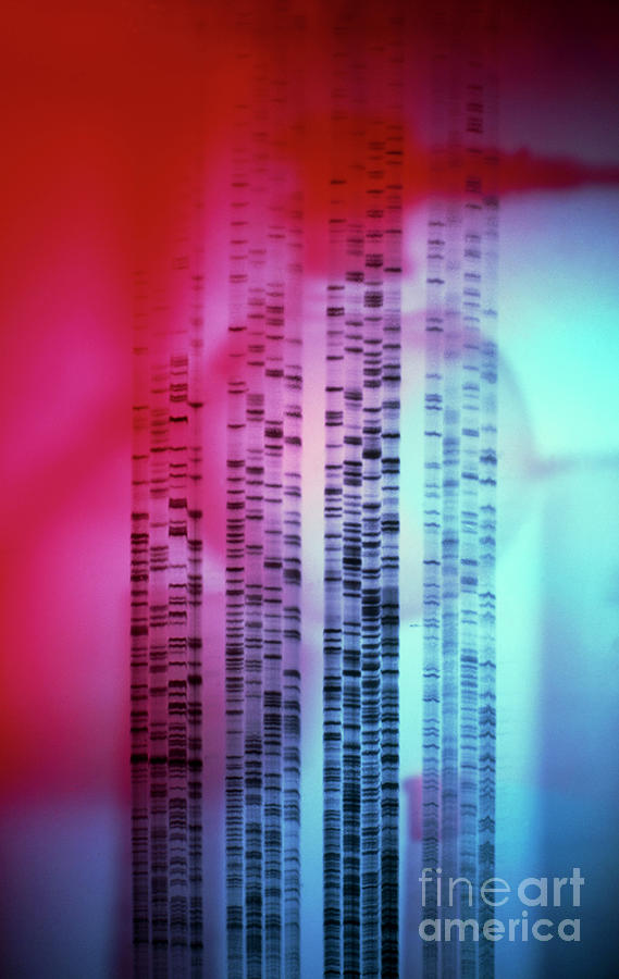 Autoradiogram Showing A Dna Fingerprint #1 Photograph by Colin Cuthbert/science Photo Library