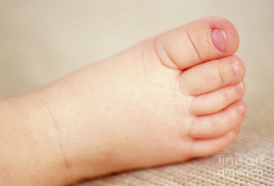 Babys Foot #1 Photograph by Paul Whitehill/science Photo Library
