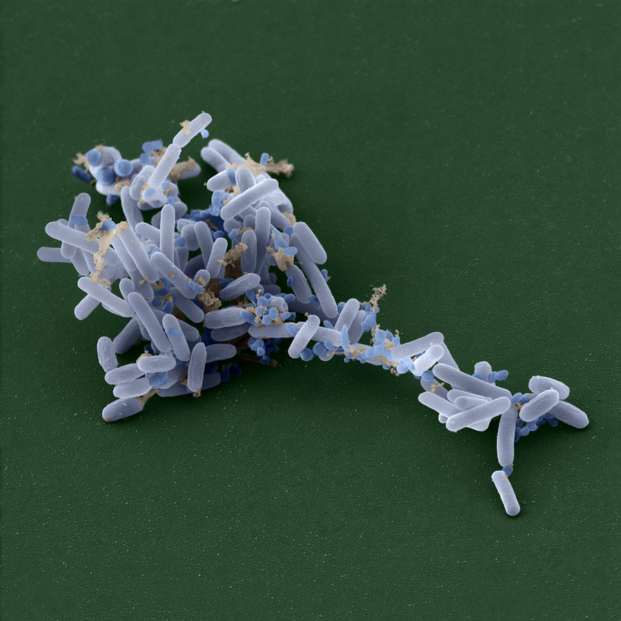 Bacillus Pumilus Sem #1 Photograph by Meckes/ottawa