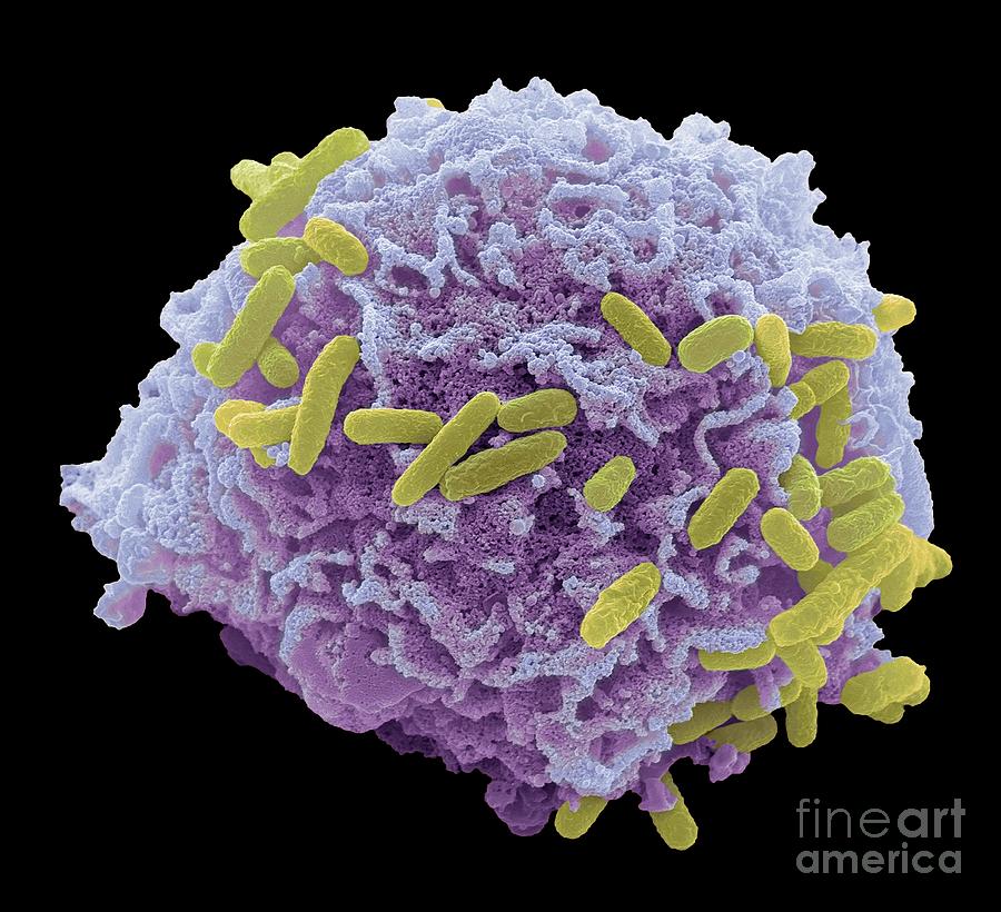 Bacterial Cell Infection Photograph By Steve Gschmeissner/science Photo ...