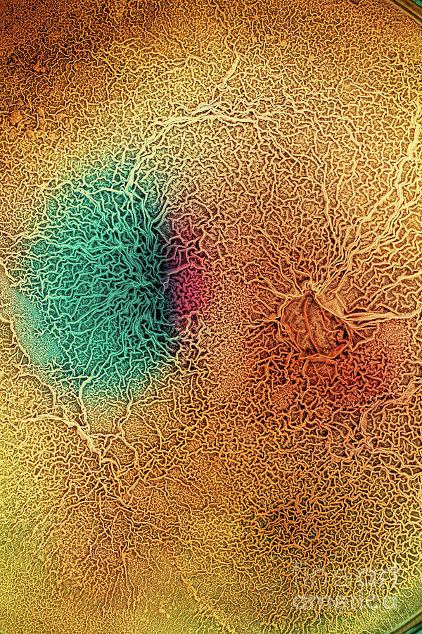 Biological Tissue Infected With Pathogenic Microorganisms #1 Photograph by Wladimir Bulgar/science Photo Library