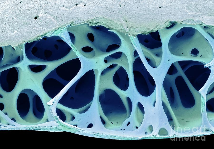 Bird Bone Tissue Photograph by Steve Gschmeissner/science Photo Library ...