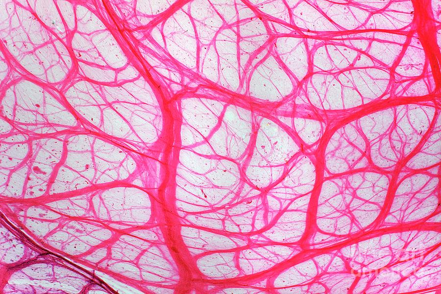 Bladder Tissue Photograph by Dr Keith Wheeler/science Photo Library