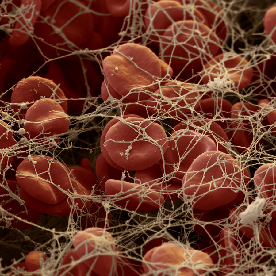 Blood Clot #1 Photograph by Oliver Meckes EYE OF SCIENCE