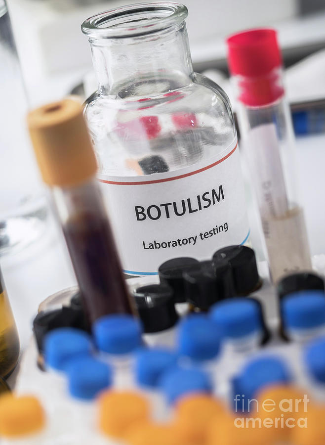 Botulism Testing In Laboratory Photograph by Photo